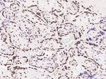MEF2D Antibody in Immunohistochemistry (Paraffin) (IHC (P))