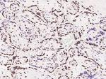 MEF2D Antibody in Immunohistochemistry (Paraffin) (IHC (P))