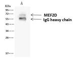 MEF2D Antibody in Immunoprecipitation (IP)