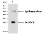 MESDC2 Antibody in Immunoprecipitation (IP)