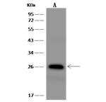 MESDC2 Polyclonal Antibody