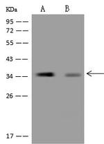 C20orf72 Polyclonal Antibody