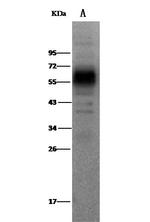 MICB Antibody in Western Blot (WB)