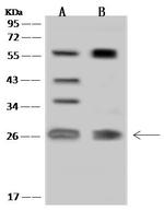 MIS12 Polyclonal Antibody