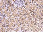 GBL Polyclonal Antibody