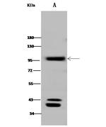 CD10 Polyclonal Antibody