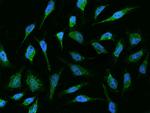 MUT Polyclonal Antibody