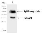 MNAT1 Antibody in Immunoprecipitation (IP)