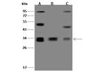 MRPL15 Polyclonal Antibody