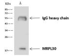 RM30 Antibody in Immunoprecipitation (IP)