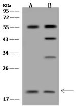 RM30 Antibody in Western Blot (WB)
