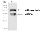 MRPL38 Antibody in Immunoprecipitation (IP)