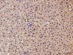 MRPL47 Antibody in Immunohistochemistry (Paraffin) (IHC (P))