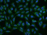 MRPS2 Polyclonal Antibody
