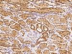 MRPS2 Antibody in Immunohistochemistry (Paraffin) (IHC (P))