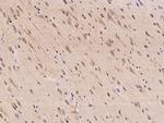 MRPS22 Antibody in Immunohistochemistry (Paraffin) (IHC (P))