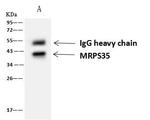 MRPS35 Antibody in Immunoprecipitation (IP)