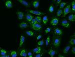 MRPS5 Polyclonal Antibody