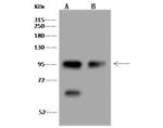 MSH2 Polyclonal Antibody