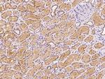 MTHFS Polyclonal Antibody
