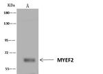 MYEF2 Antibody in Immunoprecipitation (IP)