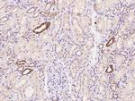 MYH10 Antibody in Immunohistochemistry (Paraffin) (IHC (P))