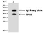 NANS Antibody in Immunoprecipitation (IP)