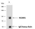 CD56 (NCAM) Antibody in Immunoprecipitation (IP)