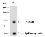 CD56 (NCAM) Antibody in Immunoprecipitation (IP)