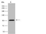 CD56 (NCAM) Antibody in Western Blot (WB)