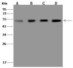 NKp46 Antibody in Western Blot (WB)