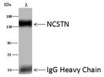 Nicastrin Antibody in Immunoprecipitation (IP)