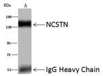 Nicastrin Antibody in Immunoprecipitation (IP)