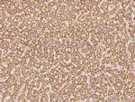 NDUFA5 Polyclonal Antibody