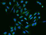 NDUFB11 Polyclonal Antibody