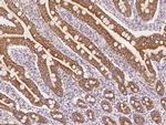 NDUFB11 Antibody in Immunohistochemistry (Paraffin) (IHC (P))