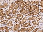NDUFB8 Antibody in Immunohistochemistry (Paraffin) (IHC (P))