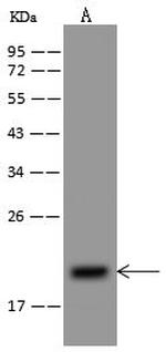 NDUFB8 Antibody in Western Blot (WB)