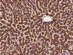 NDUFS1 Antibody in Immunohistochemistry (Paraffin) (IHC (P))