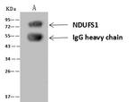 NDUFS1 Antibody in Immunoprecipitation (IP)
