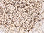 NDUFS5 Polyclonal Antibody