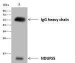 NDUFS5 Antibody in Immunoprecipitation (IP)