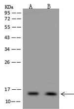 NDUFS5 Antibody in Western Blot (WB)