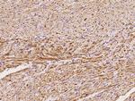 NDUFV2 Antibody in Immunohistochemistry (Paraffin) (IHC (P))