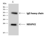 NDUFV2 Antibody in Immunoprecipitation (IP)