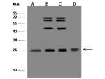 NDUFV2 Antibody in Western Blot (WB)