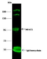 NFATC1 Antibody in Immunoprecipitation (IP)