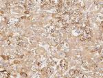 NFKB2 Antibody in Immunohistochemistry (Paraffin) (IHC (P))