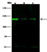 NFKB2 Antibody in Western Blot (WB)