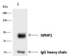 NPHP1 Antibody in Immunoprecipitation (IP)